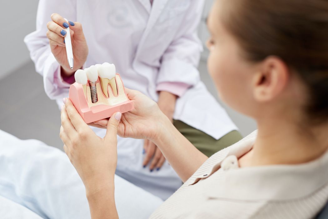 Metoda All-on-4: nowe zęby w jeden dzień – czy to możliwe?